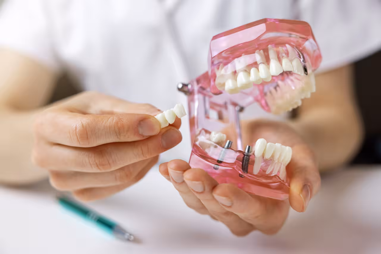 Dental Bridges in Riverview, FL